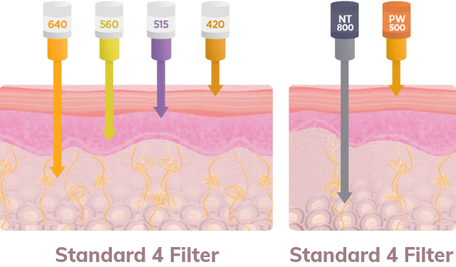 Normal 6 Filter, Special 2 Filter