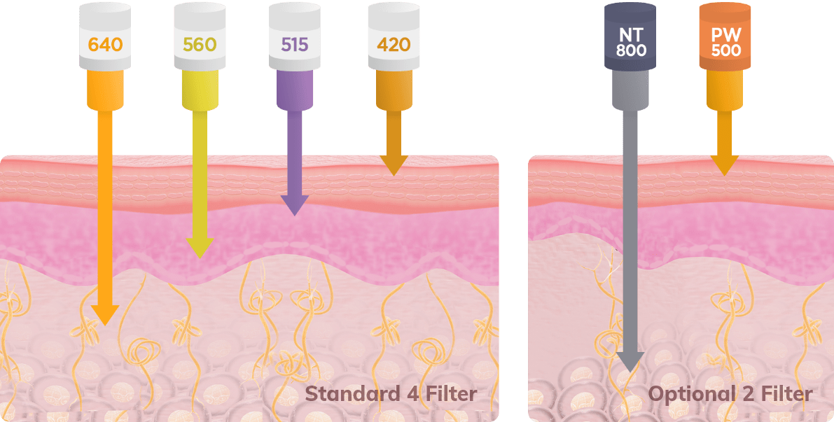 Normal 6 Filter, Special 2 Filter